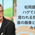 松岡昌宏がハゲていると言われる理由3選！昔の画像と比較してみた