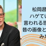 松岡昌宏がハゲていると言われる理由3選！昔の画像と比較してみた