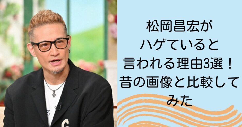 松岡昌宏がハゲていると言われる理由3選！昔の画像と比較してみた